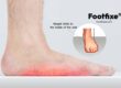 Flat Feet